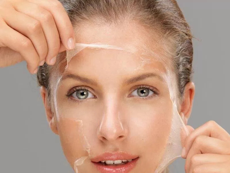 Peeling
